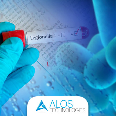 Sistemi e le tecniche per combattere la Legionella