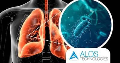 Trattamento antilegionella negli impianti idrici: cosa succede se non si interviene in tempo